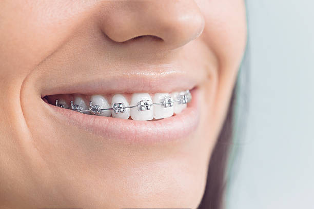Best Invisalign and Clear Aligners  in Orleans, VT